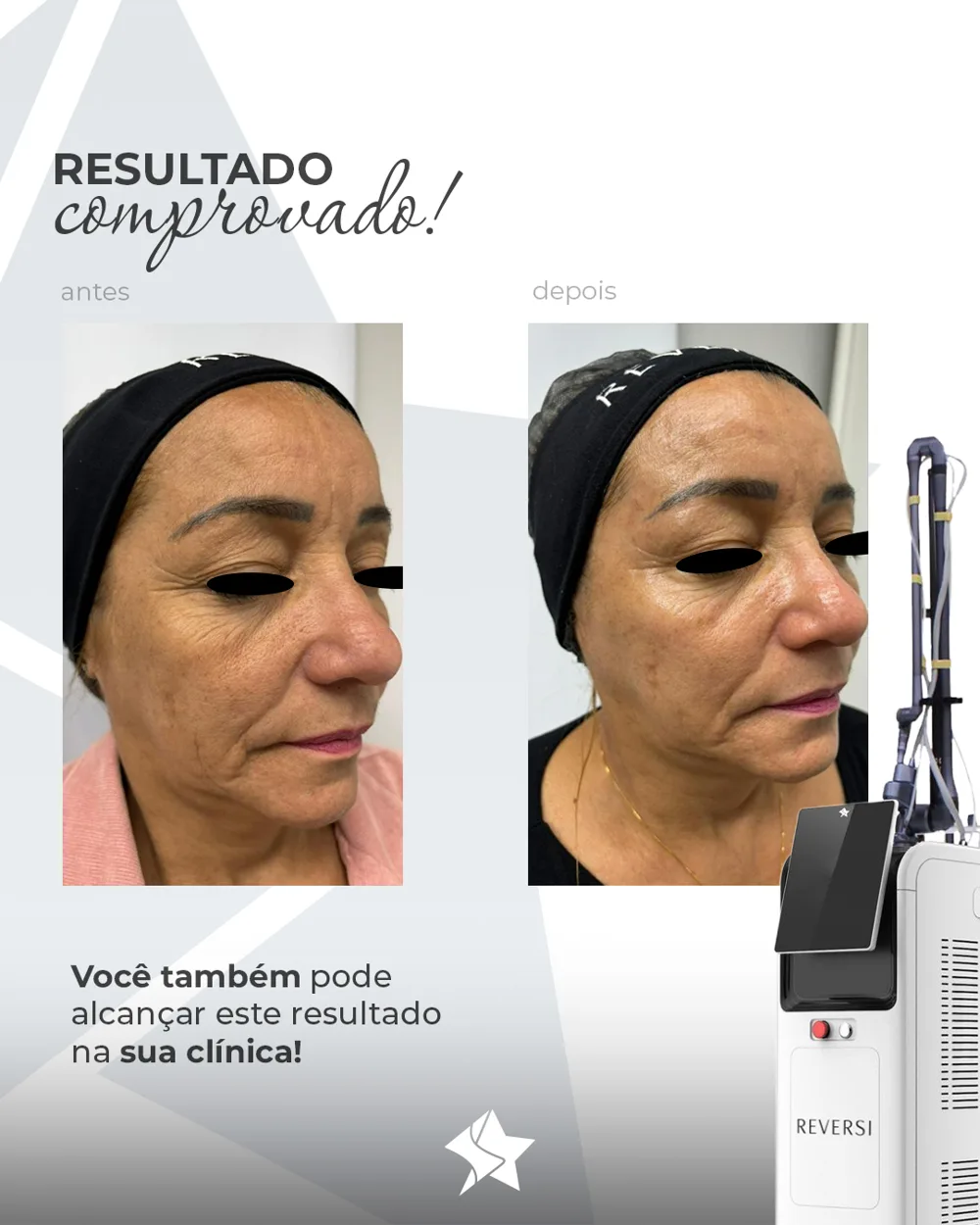 Antes e depois Reversi caso 3