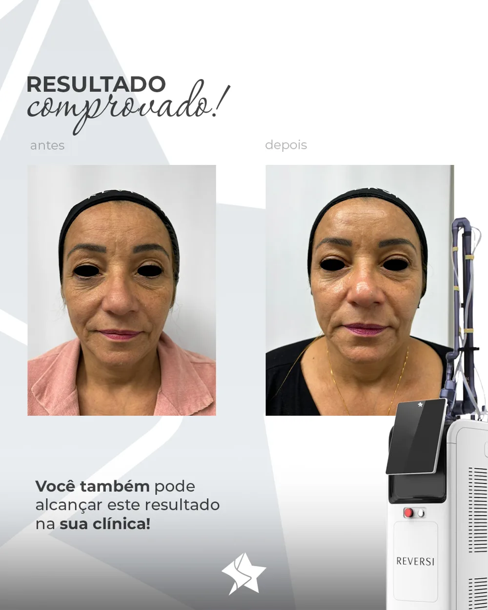 Antes e depois Reversi caso 2